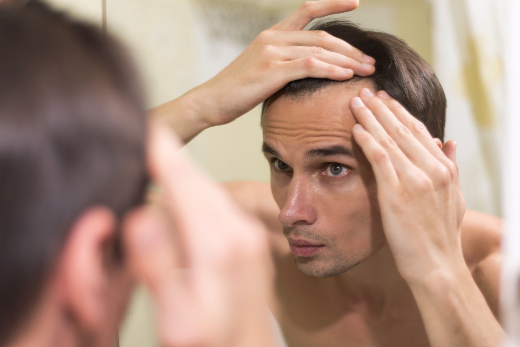 alopecia juvenil